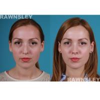 Rawnsley Plastic Surgery image 3